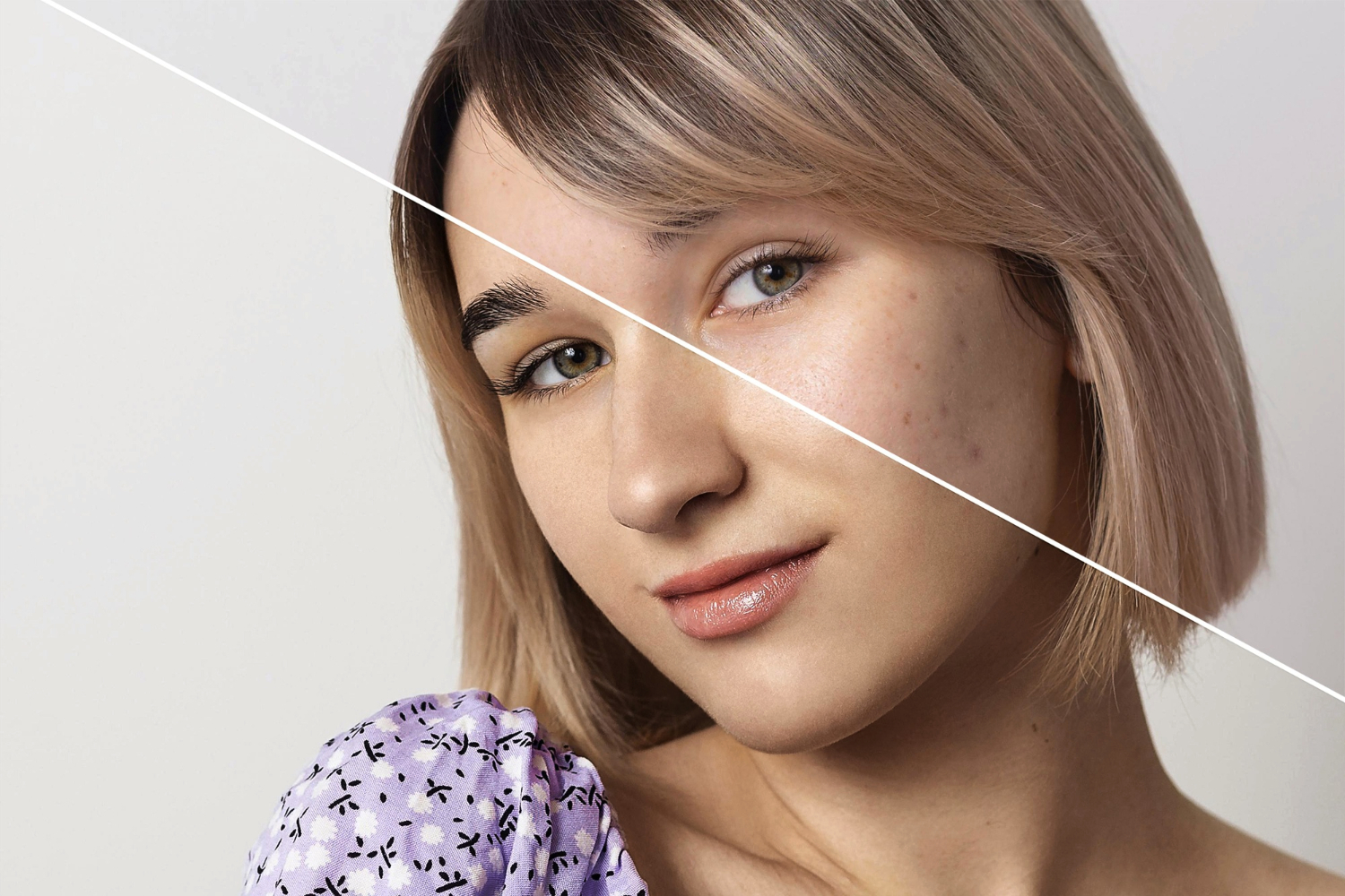 Do czego używa się botoxu? Jak działa botox.